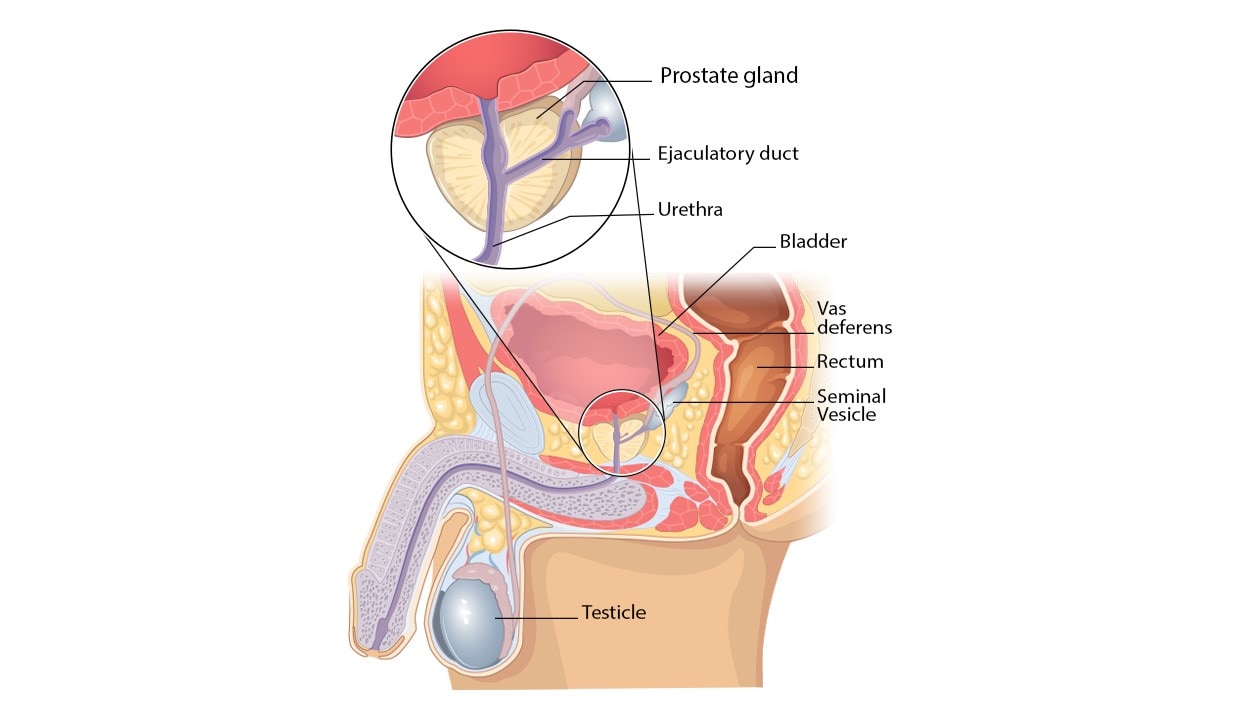 Diagram showing the location of the prostate