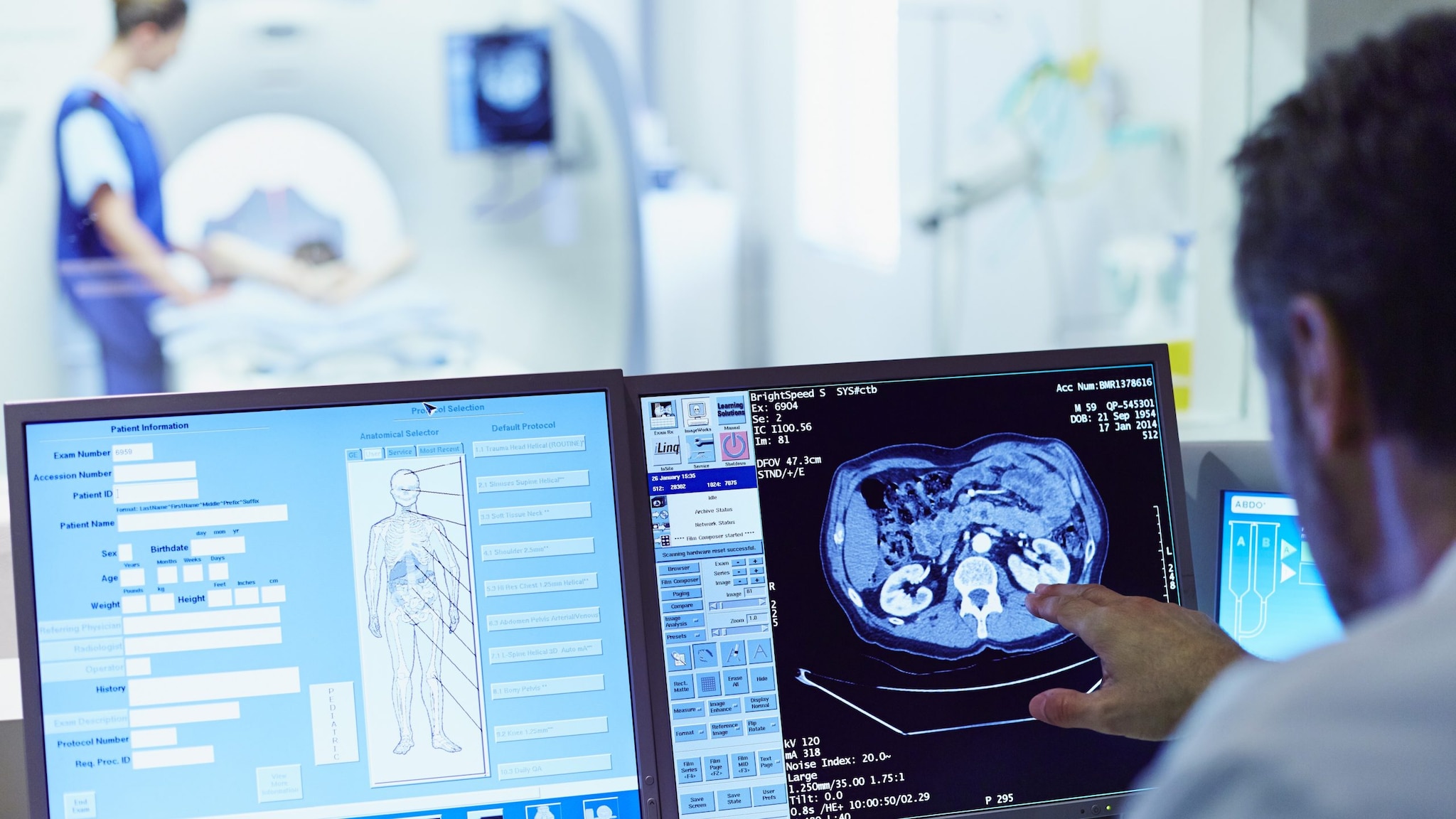 A doctor points at a brain scan on computer screen