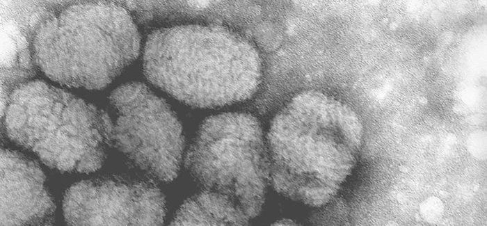 A transmission electron micrograph (TEM) of smallpox virus particles.