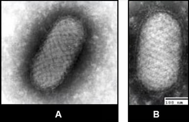 Figure 5EM of parapoxvirus (Orf virus) from tissue culture (5-A) and clinical specimen (5-B).