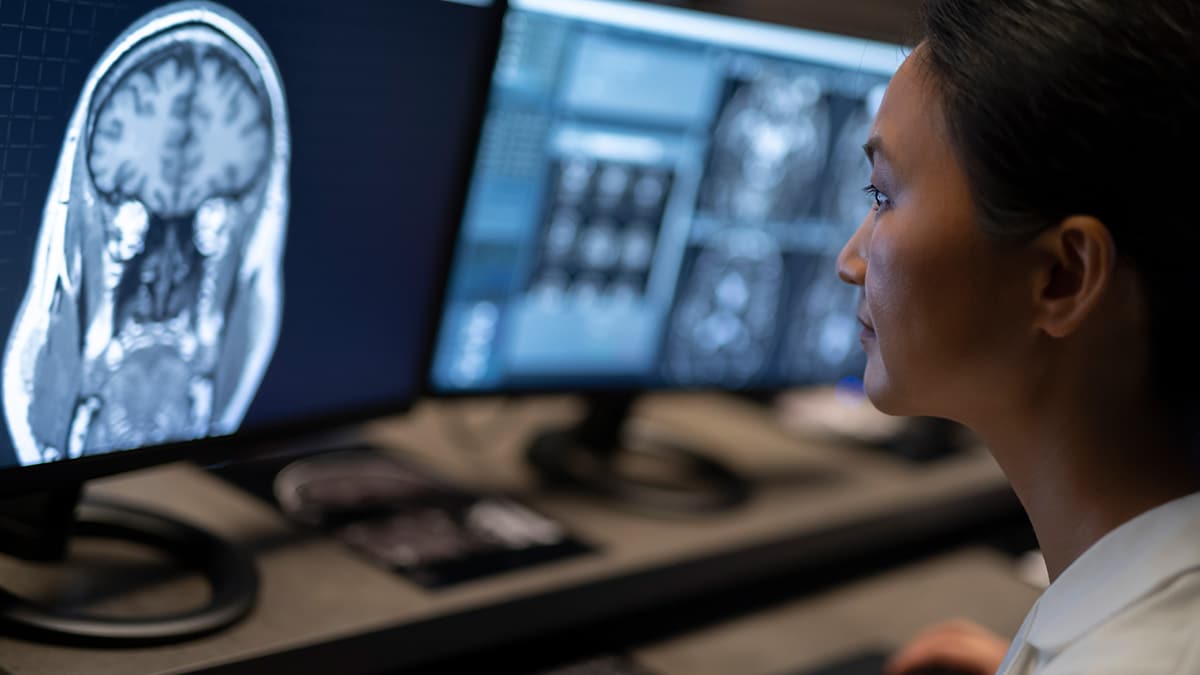 Health care worker reviewing brain scans on a computer monitor