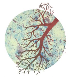 Mycobacterium tuberculosis