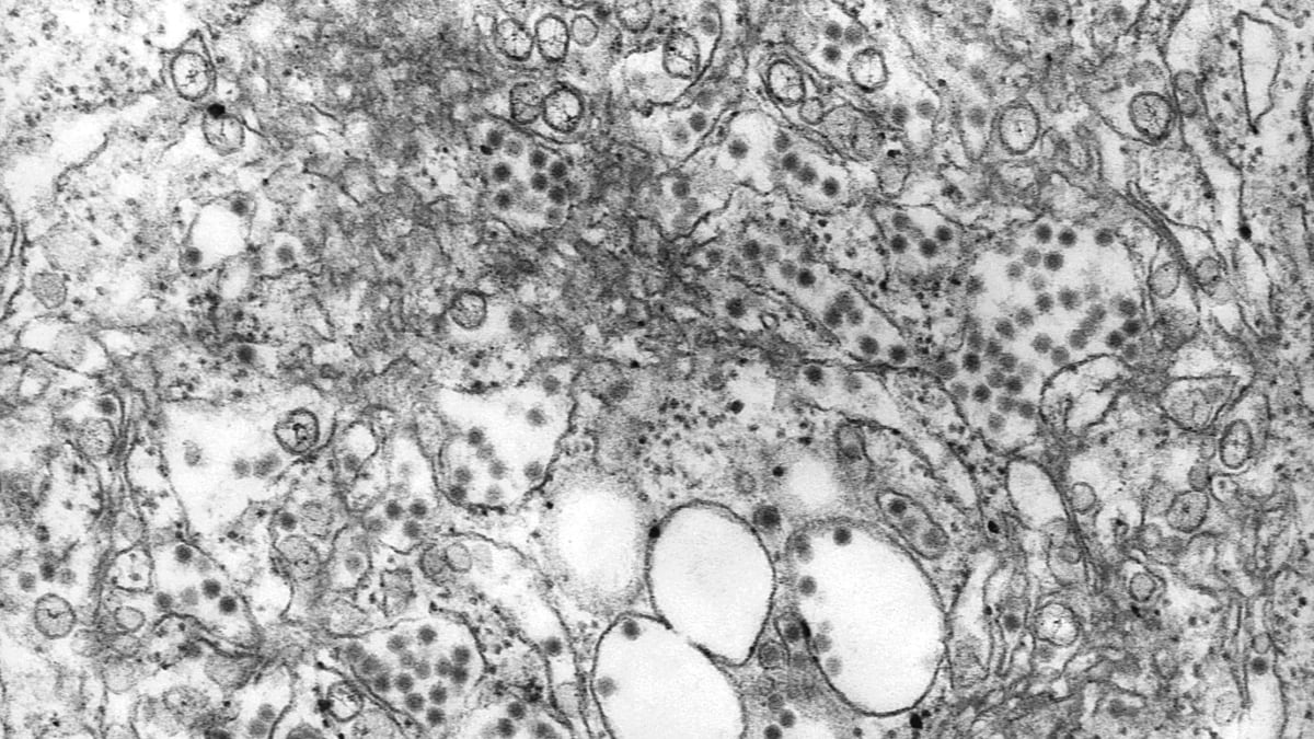 Transmission electron microscopic image of tick-borne encephalitis virus