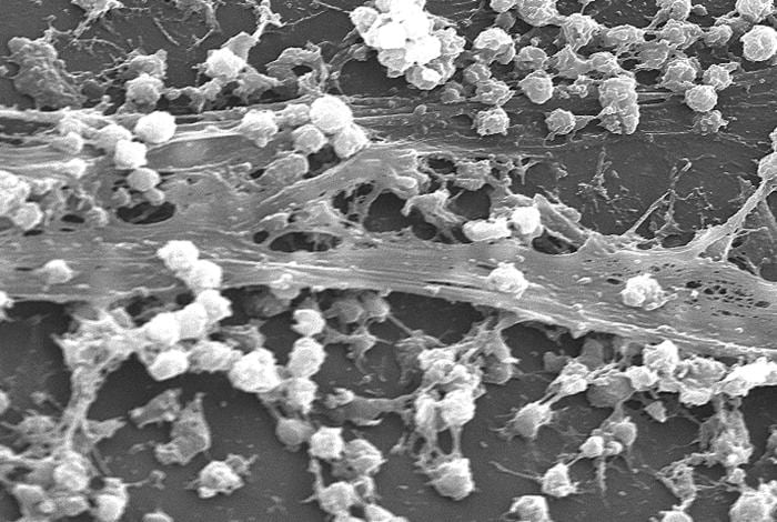 Scanning electron micrograph of S. aureus bacteria on the luminal surface of an indwelling catheter with interwoven complex matrix of extracellular polymeric substances known as a biofilm.