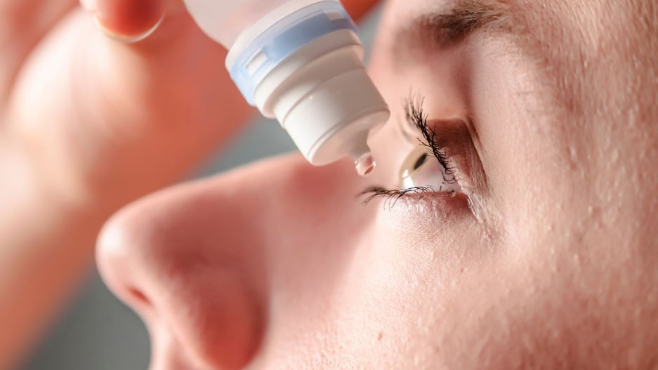 woman putting eye drops in eye